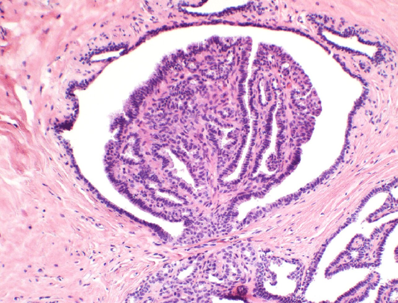 Mammapathologie 2