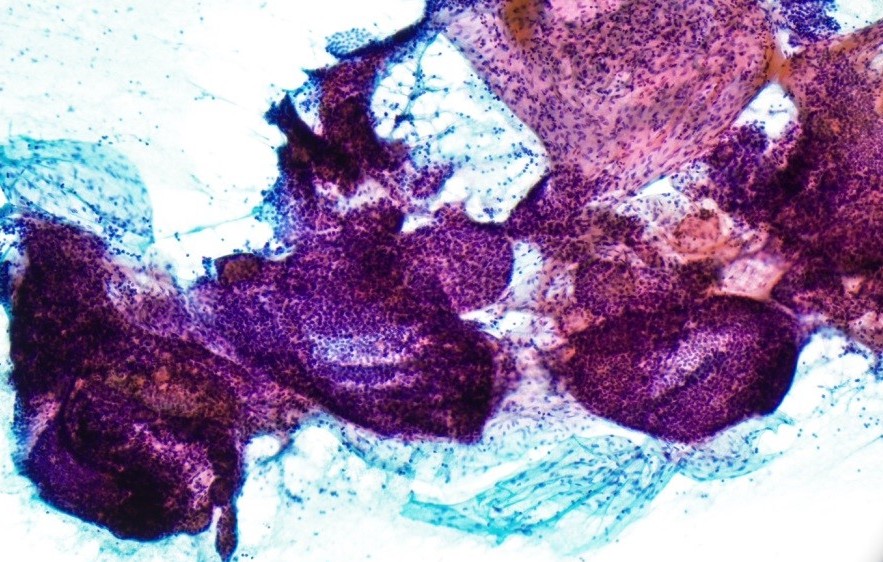 Extragenitale Zytologie